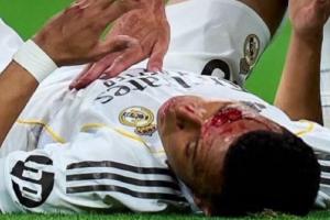 阿斯报：姆巴佩将首发出战拜仁，他不会佩戴面具